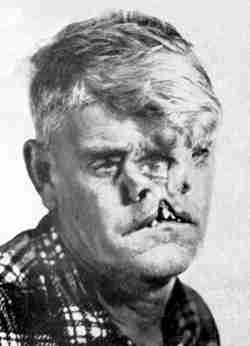 Bill Durks - The Two Face Man