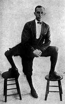 Frank Lentini the three legged man