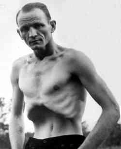 Melvin Burkhart "Anatomical Wonder - Human Blockhead"